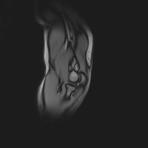 Click on the Serie image to view the images of Wieszt, Gnter